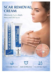 ScarAway Scar Removal Cream (Pack of 2)