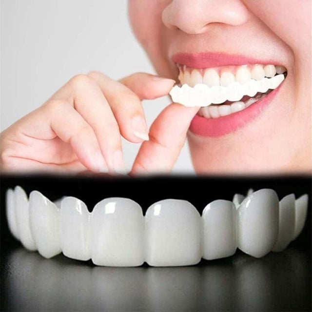 Clip-on Teeth