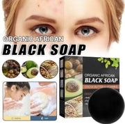 Jaysuing Organic African Black Soap (Pack of 1)