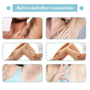 Hair Removal Spray 100 ml (PACK OF 1)