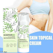 Anti Fungal Cream (Pack of 2)
