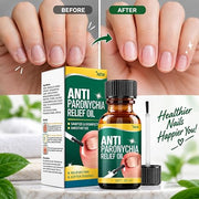 Anti Paronychia Relief Oil (Pack of 3)