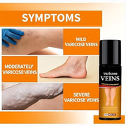 Varicose Veins Spray (Pack of 2)
