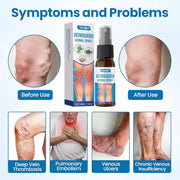 VeinGuard Herbal Spray (Pack of 2)
