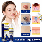 Bump Renewal Spray (Pack of 2)