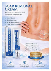 ScarAway Scar Removal Cream (Pack of 2)