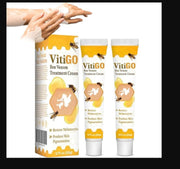 Bee Venom Vitiligo Treatment Cream, Fivfivgo Vitiligo Treatment Cream, Bee Venom Treatment Cream (Pack of 2)