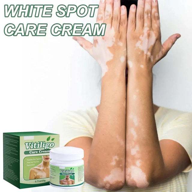VITILIGO Care Cream - Restore your Natural Beauty (Pack of 2)