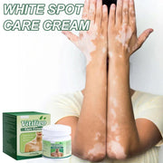 VITILIGO Care Cream - Restore your Natural Beauty (Pack of 2)