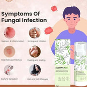 Fungal Cream For Men & Women