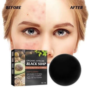 Jaysuing Organic African Black Soap (Pack of 1)