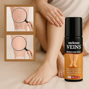 Varicose Veins Spray (Pack of 2)