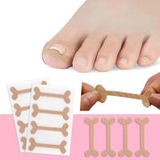 Nail Correction Patches (Pack of 4)