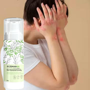 Anti Fungal Cream (Pack of 2)