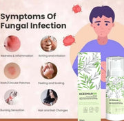 Anti Fungal Cream (Pack of 2)