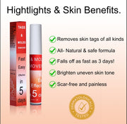 Skin Tags & Moles Remover