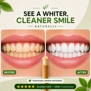 Teeth Whitening Miswak Sticks(Pack of 30)