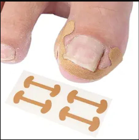 Nail Correction Patches (Pack of 4)