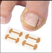 Nail Correction Patches (Pack of 4)