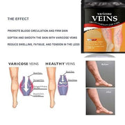 Varicose Veins Relief Patches (Pack of 30)