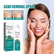 South Moon Medical Grade Scar Spray ( Pack Of 2 )
