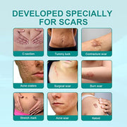 South Moon Medical Grade Scar Spray ( Pack Of 2 )