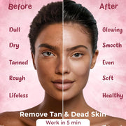 Tanning Dead Skin Remover 100 ml ( Pack of 2 )